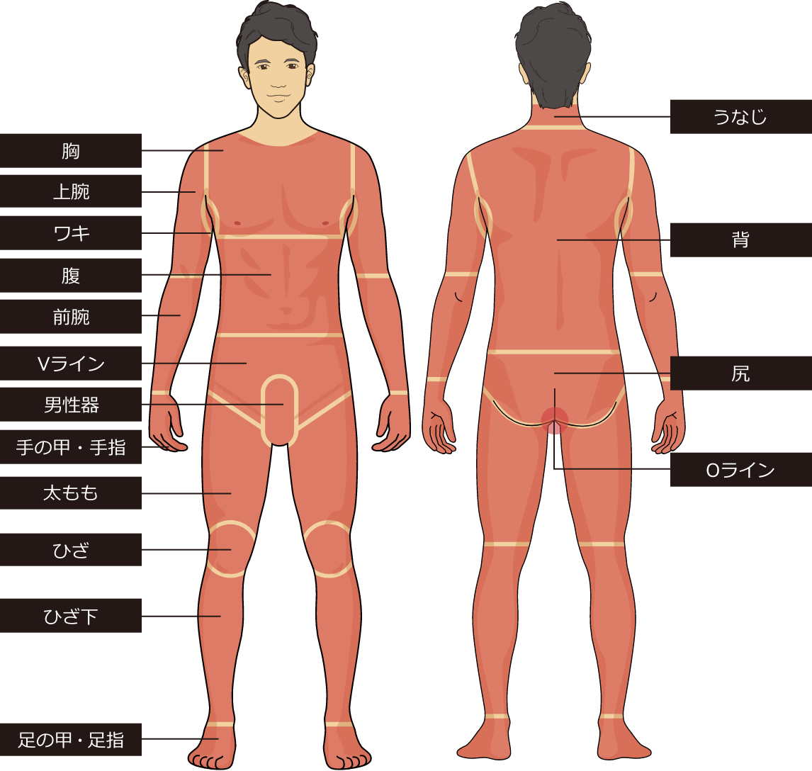 ゴリラクリニックの全身脱毛部位