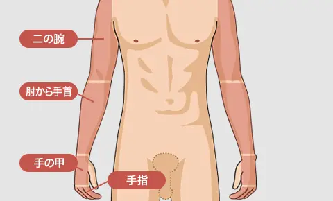 ゴリラクリニックの腕全体脱毛部位