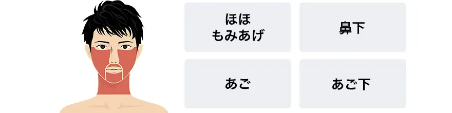 メンズリゼ京都四条のヒゲ全体脱毛セット